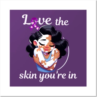 Love The Skin You're In Vitiligo Awareness and Acceptance Posters and Art